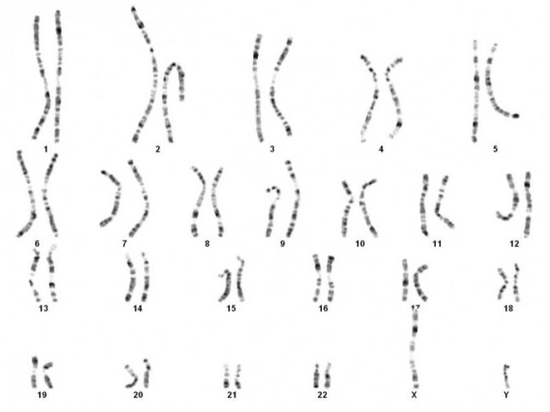 Caryotype sanguin